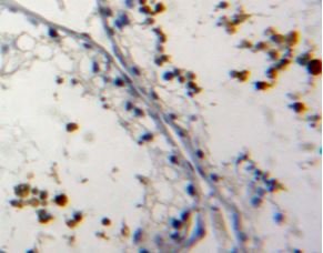 Immunohistochemistry (Formalin/PFA-fixed paraffin-embedded sections) - Anti-Nucleoporin p62/NUP62 antibody (AB232816)