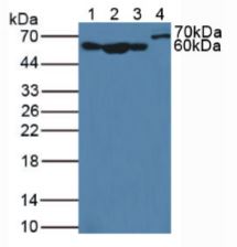 Western blot - Anti-Nucleoporin p62/NUP62 antibody (AB232816)