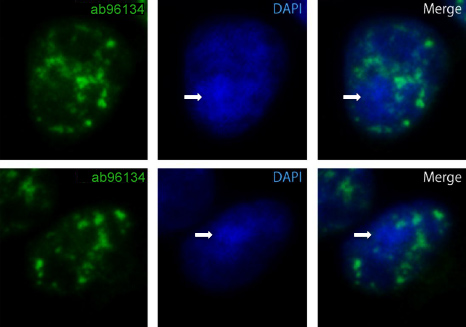 Immunocytochemistry/ Immunofluorescence - Anti-Nucleoporin p62/NUP62 antibody (ab96134), expandable thumbnail