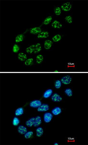 Immunocytochemistry/ Immunofluorescence - Anti-Nucleoporin p62/NUP62 antibody (AB96134), expandable thumbnail
