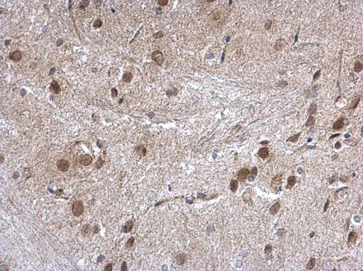 Immunohistochemistry (Formalin/PFA-fixed paraffin-embedded sections) - Anti-Nucleoporin p62/NUP62 antibody (AB96134), expandable thumbnail