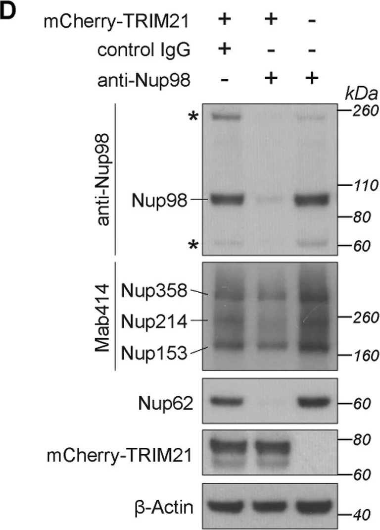 Western blot - Anti-Nucleoporin p62/NUP62 antibody (AB96134)