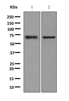 Western blot - Anti-Nucleoporin p62/NUP62 antibody [EPR9919] (AB140651)