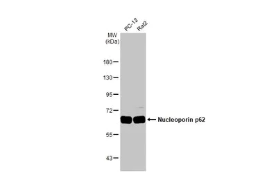 Western blot - Anti-Nucleoporin p62/NUP62 antibody [HL1226] - BSA and Azide free (AB313836)