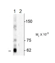 Western blot - Anti-Nucleoporin p62/NUP62 (phospho T269 + S272) antibody (AB183480)