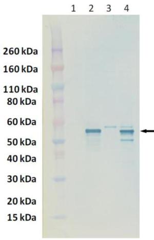 Western blot - Anti-Nucleoprotein Crimean-Congo hemorrhagic fever virus antibody (AB190657), expandable thumbnail