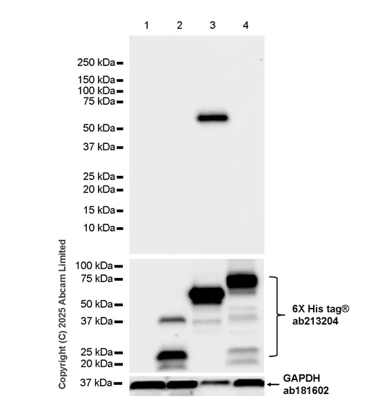 Western blot - Anti-Nucleoprotein Crimean-Congo hemorrhagic fever virus antibody [BA11] (AB324964)