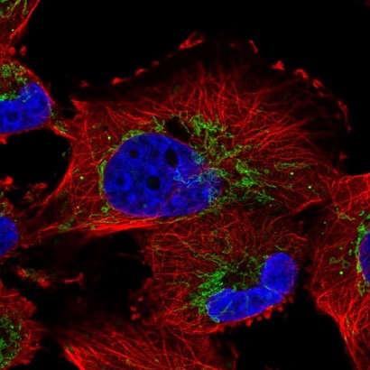 Immunocytochemistry/ Immunofluorescence - Anti-Nucleoside Diphosphate Kinase 7 antibody (AB220753), expandable thumbnail