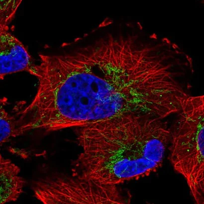 Immunocytochemistry/ Immunofluorescence - Anti-Nucleoside Diphosphate Kinase 7 antibody (AB220753)