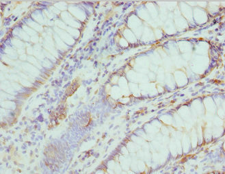 Immunohistochemistry (Formalin/PFA-fixed paraffin-embedded sections) - Anti-Nucleoside-diphosphate kinase antibody (AB225940)