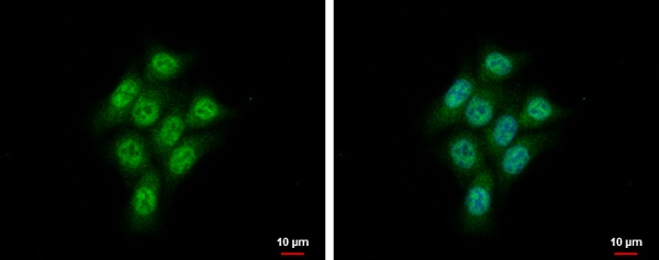 Immunocytochemistry/ Immunofluorescence - Anti-Nucleoside-diphosphate kinase antibody (AB228609), expandable thumbnail