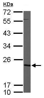Western blot - Anti-Nucleoside-diphosphate kinase antibody (AB228609), expandable thumbnail