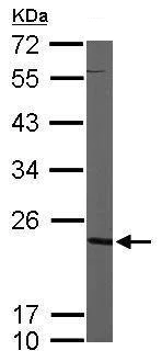 Western blot - Anti-Nucleoside-diphosphate kinase antibody (AB228609)