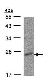 Western blot - Anti-Nucleoside-diphosphate kinase antibody (AB228609)