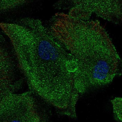 Immunocytochemistry/ Immunofluorescence - Anti-Nucleoside phosphorylase antibody (AB244255), expandable thumbnail