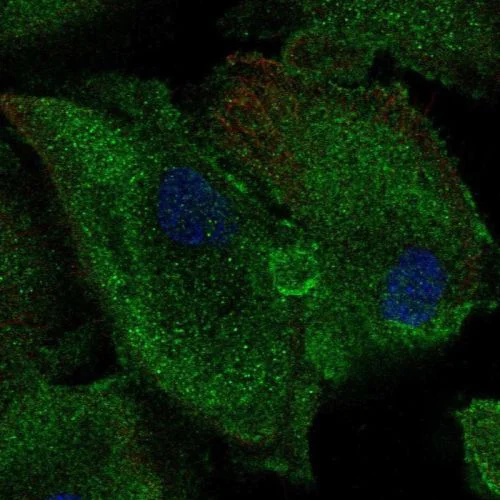 Immunocytochemistry/ Immunofluorescence - Anti-Nucleoside phosphorylase antibody (AB244255)