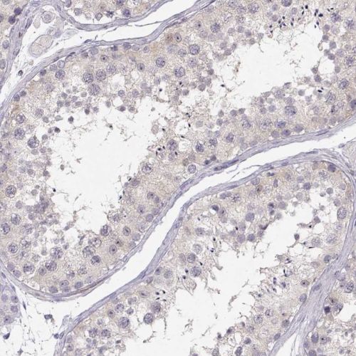 Immunohistochemistry (Formalin/PFA-fixed paraffin-embedded sections) - Anti-Nucleoside phosphorylase antibody (AB244255), expandable thumbnail