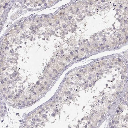 Immunohistochemistry (Formalin/PFA-fixed paraffin-embedded sections) - Anti-Nucleoside phosphorylase antibody (AB244255)