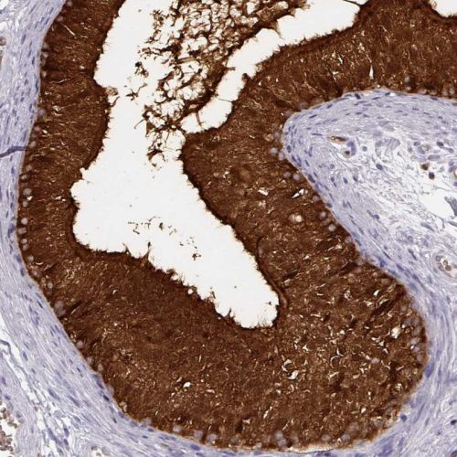 Immunohistochemistry (Formalin/PFA-fixed paraffin-embedded sections) - Anti-Nucleoside phosphorylase antibody (AB244255), expandable thumbnail