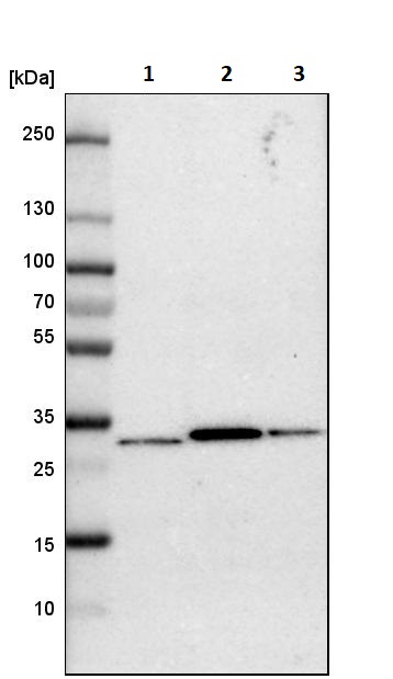 Western blot - Anti-Nucleoside phosphorylase antibody (AB244255), expandable thumbnail