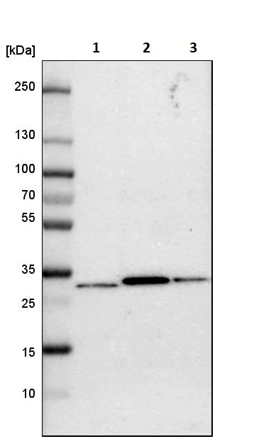 Western blot - Anti-Nucleoside phosphorylase antibody (AB244255)