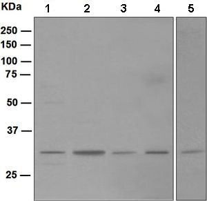 Western blot - Anti-Nucleoside phosphorylase antibody [EPR5715] (AB109447)