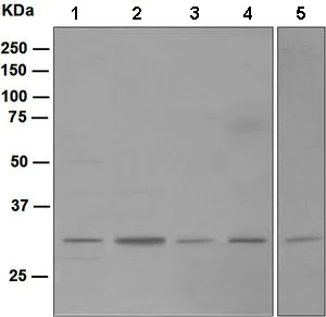 Western blot - Anti-Nucleoside phosphorylase antibody [EPR5715] (AB109447)