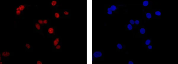 Immunocytochemistry/ Immunofluorescence - Anti-Nucleoside triphosphate phosphohydrolase antibody [EPR14325-50] - BSA and Azide free (AB250597)