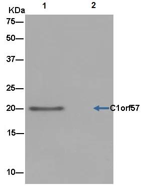 Immunoprecipitation - Anti-Nucleoside triphosphate phosphohydrolase antibody [EPR14325-50] - BSA and Azide free (AB250597)