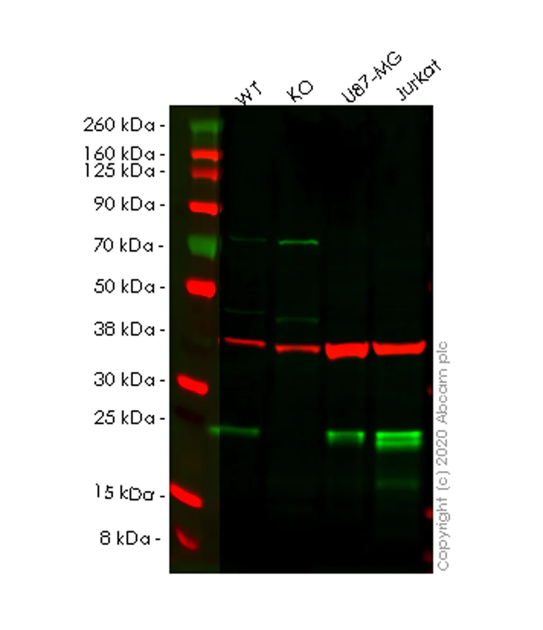 Western blot - Anti-Nucleoside triphosphate phosphohydrolase antibody [EPR14325-50] - BSA and Azide free (AB250597)