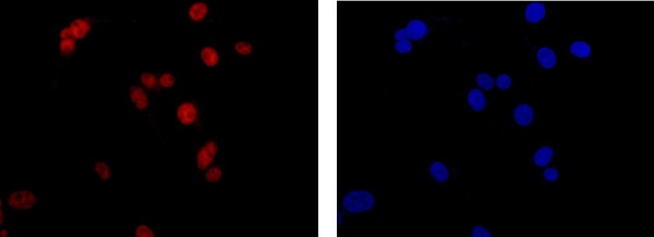 Immunocytochemistry/ Immunofluorescence - Anti-Nucleoside triphosphate phosphohydrolase antibody [EPR14325-50] - N-terminal (AB182155)