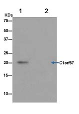 Immunoprecipitation - Anti-Nucleoside triphosphate phosphohydrolase antibody [EPR14325] (AB182154), expandable thumbnail