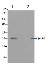 Immunoprecipitation - Anti-Nucleoside triphosphate phosphohydrolase antibody [EPR14325] (AB182154)