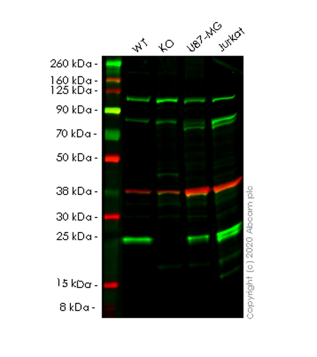 Western blot - Anti-Nucleoside triphosphate phosphohydrolase antibody [EPR14325] (AB182154), expandable thumbnail