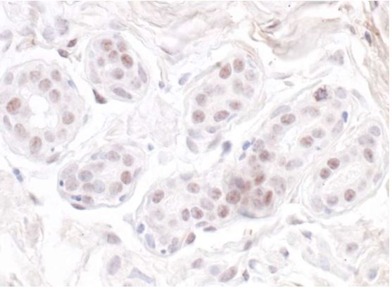 Immunohistochemistry (Formalin/PFA-fixed paraffin-embedded sections) - Anti-Nucleostemin antibody (AB70346), expandable thumbnail