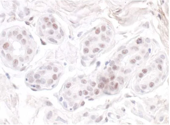 Immunohistochemistry (Formalin/PFA-fixed paraffin-embedded sections) - Anti-Nucleostemin antibody (AB70346)