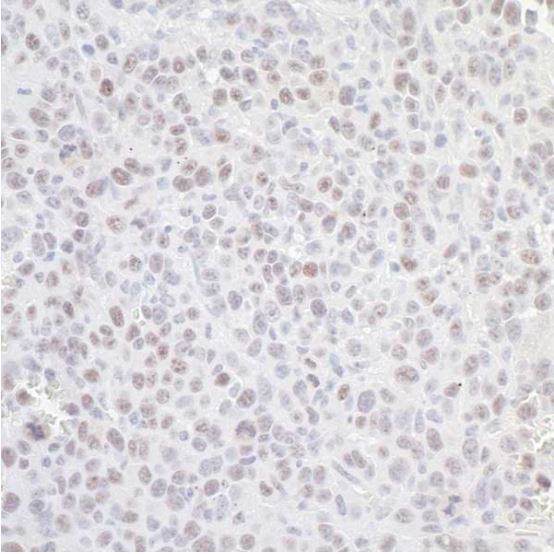 Immunohistochemistry (Formalin/PFA-fixed paraffin-embedded sections) - Anti-Nucleostemin antibody (AB70346), expandable thumbnail