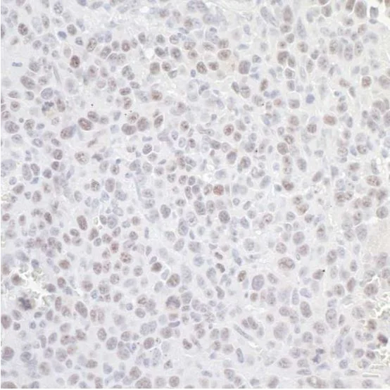 Immunohistochemistry (Formalin/PFA-fixed paraffin-embedded sections) - Anti-Nucleostemin antibody (AB70346)