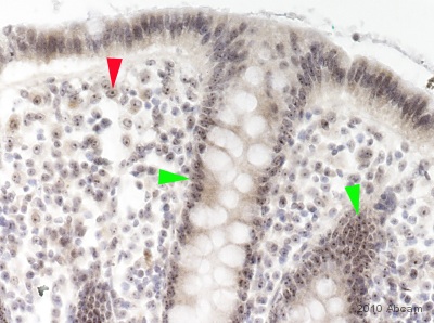 Immunohistochemistry (Formalin/PFA-fixed paraffin-embedded sections) - Anti-Nucleostemin antibody (ab70346), expandable thumbnail
