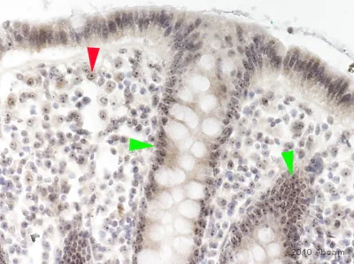 Immunohistochemistry (Formalin/PFA-fixed paraffin-embedded sections) - Anti-Nucleostemin antibody (AB70346)