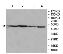 Western blot - Anti-NUDT12 antibody (AB197310)