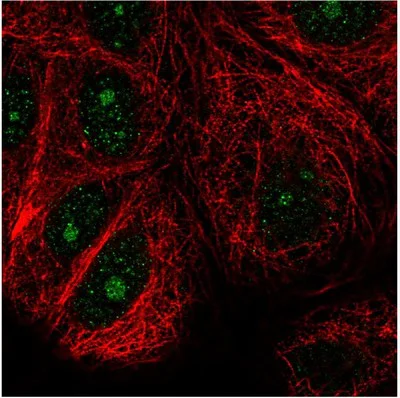 Immunocytochemistry/ Immunofluorescence - Anti-NUDT16 antibody (AB204739)