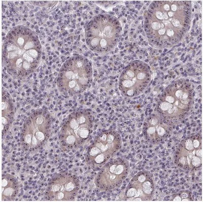 Immunohistochemistry (Formalin/PFA-fixed paraffin-embedded sections) - Anti-NUDT16 antibody (AB204739)