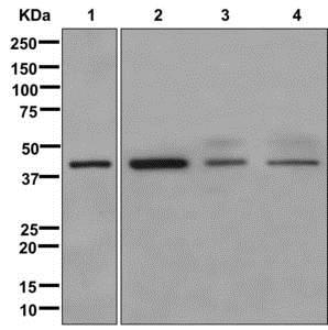 Western blot - Anti-NUDT19 antibody [EPR13162-106] - BSA and Azide free (AB250171), expandable thumbnail