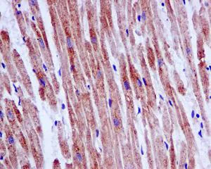 Immunohistochemistry (Formalin/PFA-fixed paraffin-embedded sections) - Anti-NUDT19 antibody [EPR13162-63] (AB180166)