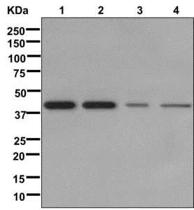 Western blot - Anti-NUDT19 antibody [EPR13162-63] (AB180166)