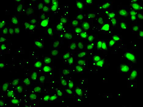 Immunocytochemistry/ Immunofluorescence - Anti-NUDT2 antibody (AB210769)