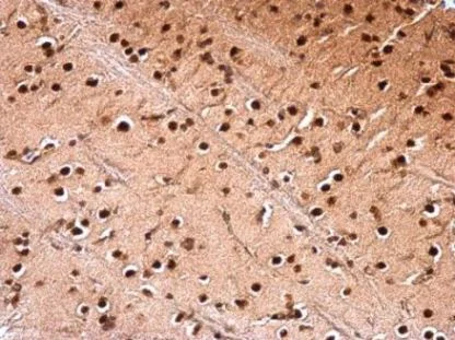 Immunohistochemistry (Formalin/PFA-fixed paraffin-embedded sections) - Anti-NUDT21/CFIM25 antibody (AB183660)