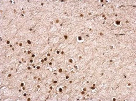 Immunohistochemistry (Formalin/PFA-fixed paraffin-embedded sections) - Anti-NUDT21/CFIM25 antibody (AB183660)