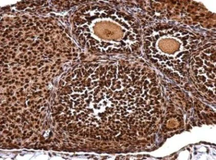 Immunohistochemistry (Formalin/PFA-fixed paraffin-embedded sections) - Anti-NUDT21/CFIM25 antibody (AB183660)